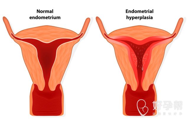 试管成功率最好的医院排名 哪家医院最适合做试管婴儿？