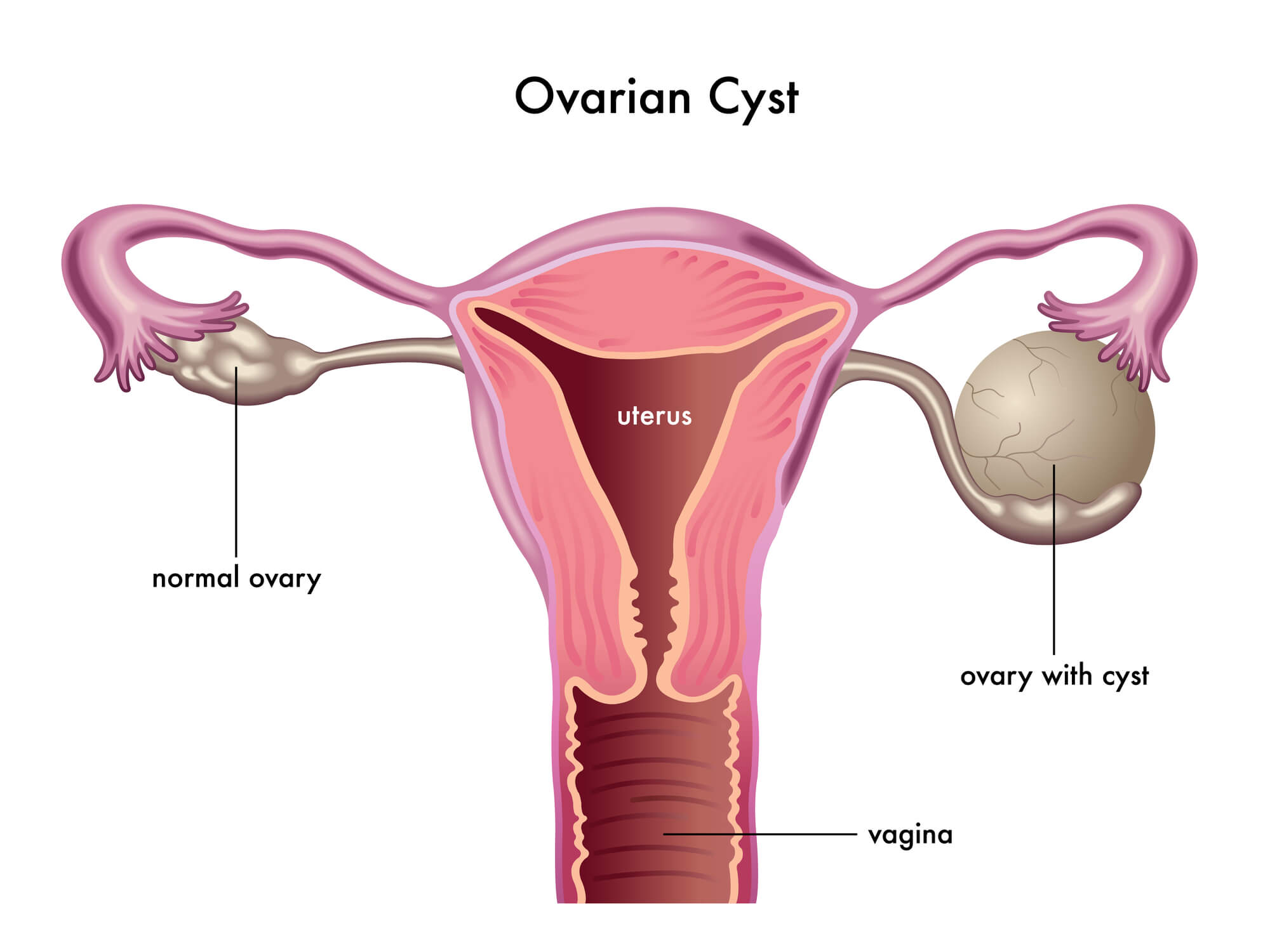 卵巢早衰是不是就没希望怀孕了?卵巢早衰做泰国试管婴儿成功几率大吗?