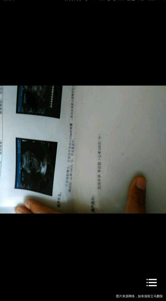 人流两次,这次好孕终于打消了我的顾虑,千万不要学我