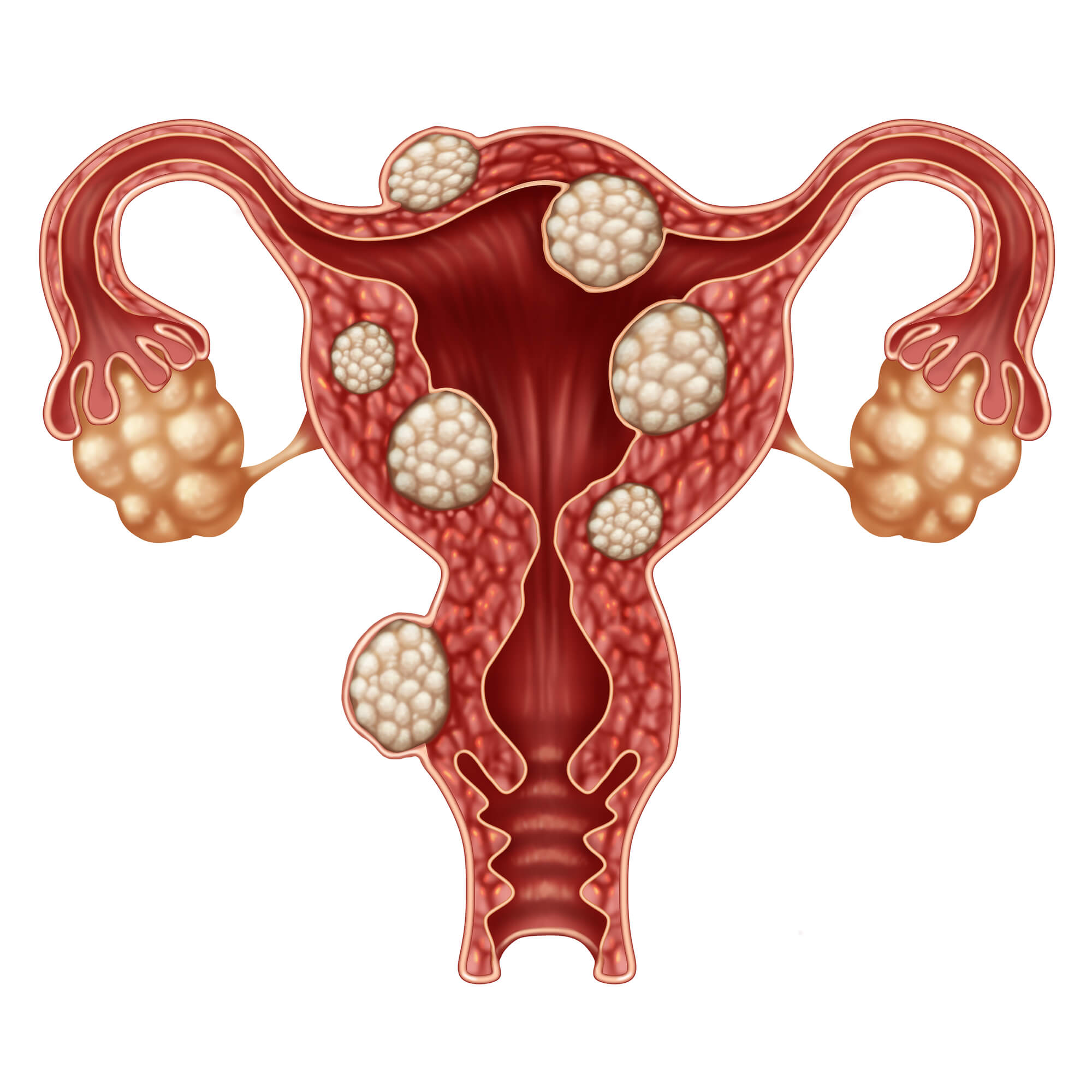 泰国试管婴儿降调促排联动：了解科学调控卵巢功能的重要性