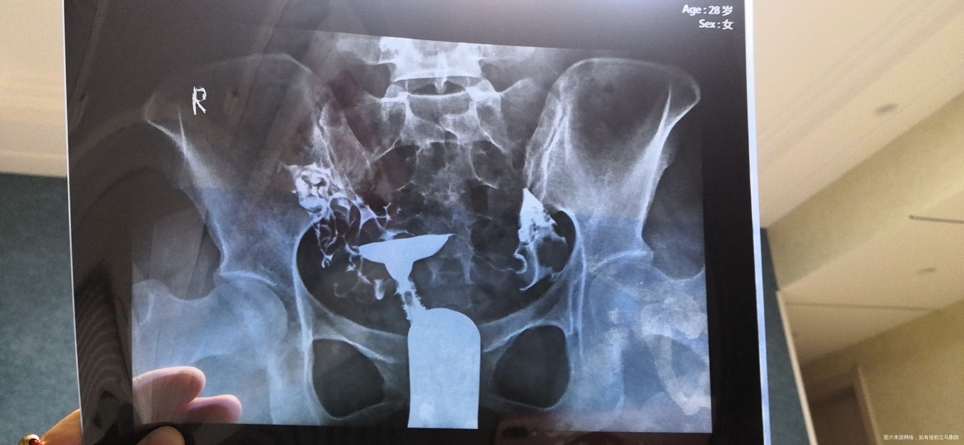 麻烦帮我看看有什么问题该做什么治疗谢谢了