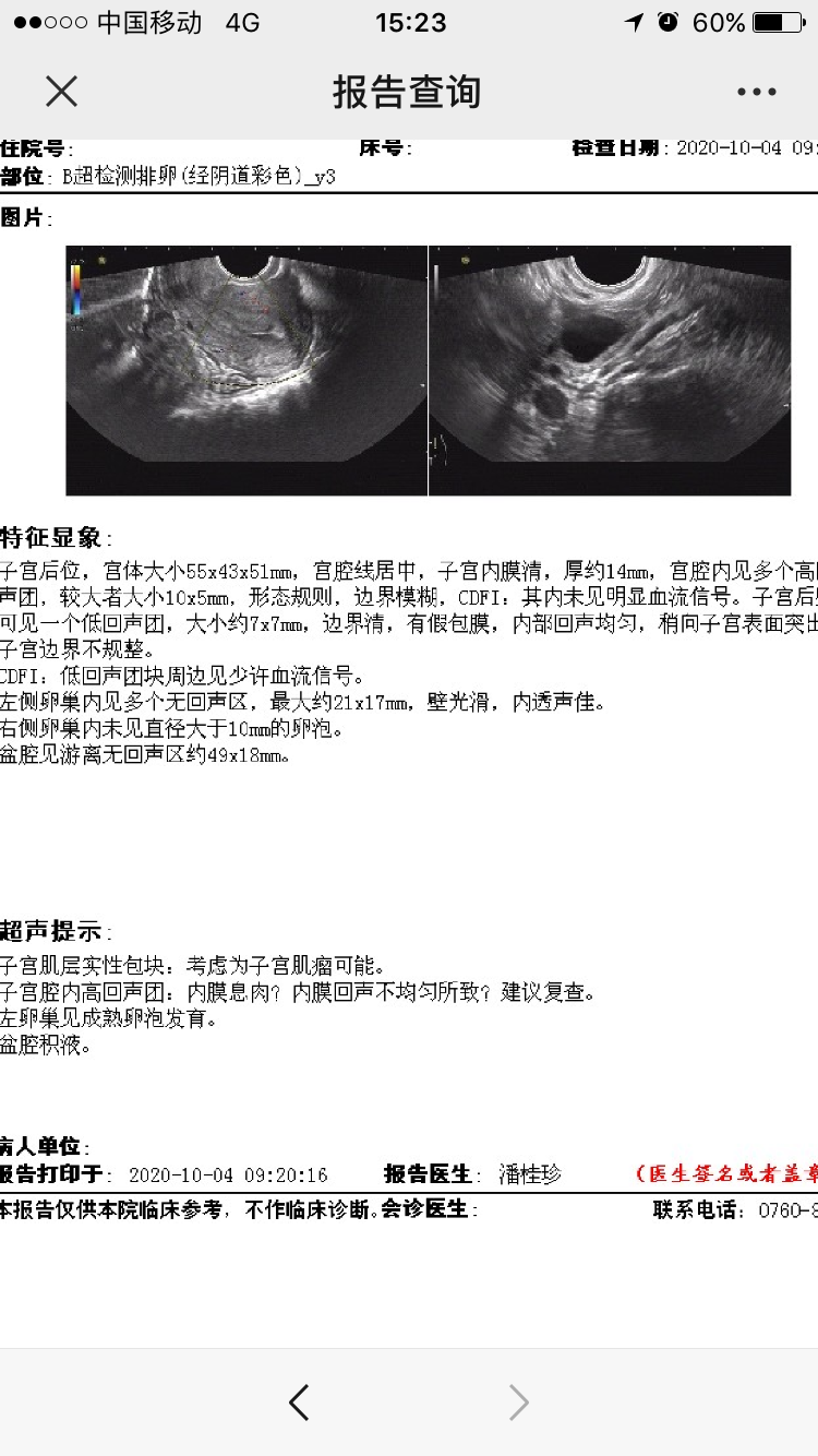 医生你好我之前做了B超怀疑有子宫内膜息肉请问