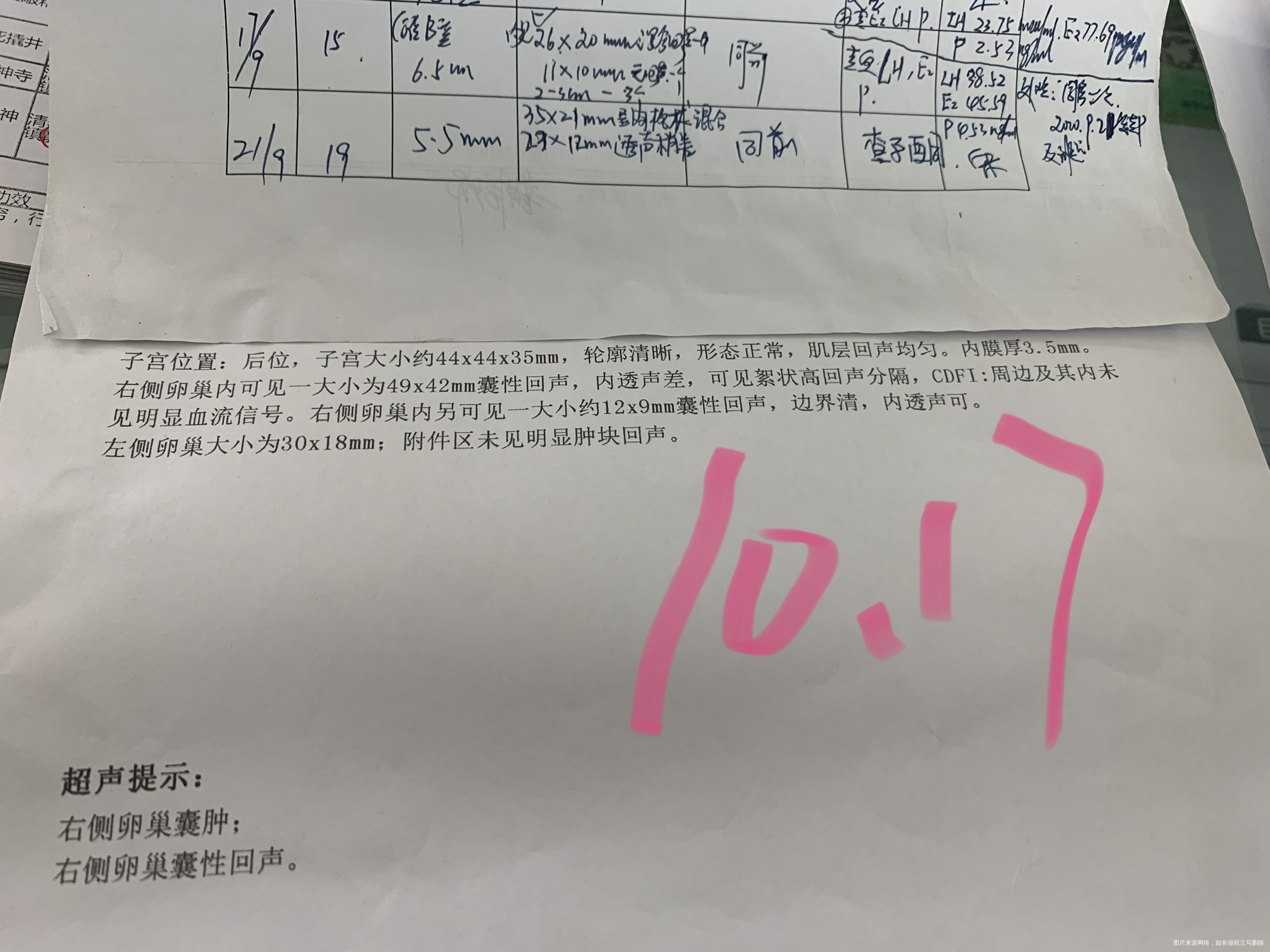 10月6号来例假经期第3天开始口服来曲唑片促