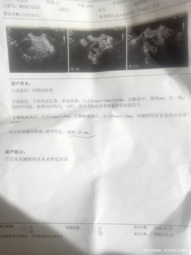 输卵管结核吃药一年半了在结核科和妇科来回跑妇