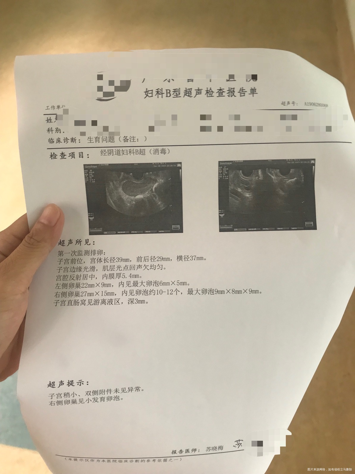 2017年做过宫颈环切手术2018年10月月