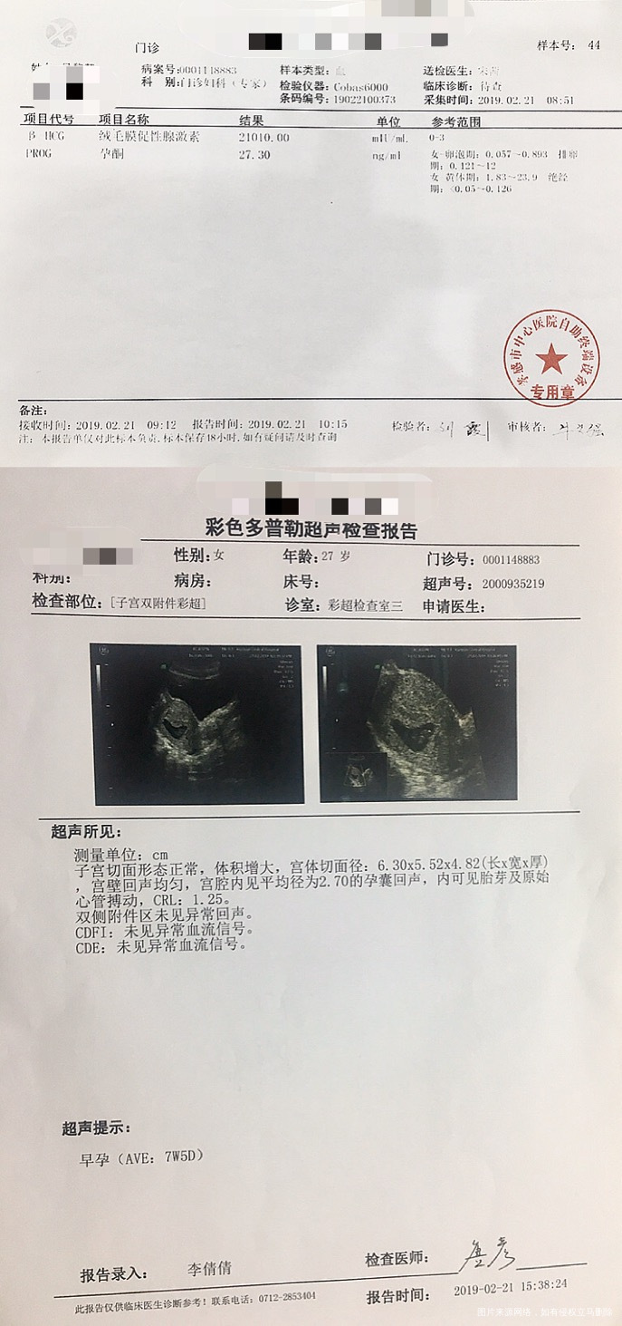 2019年初自然怀孕快8周左右B超检查胎心胎