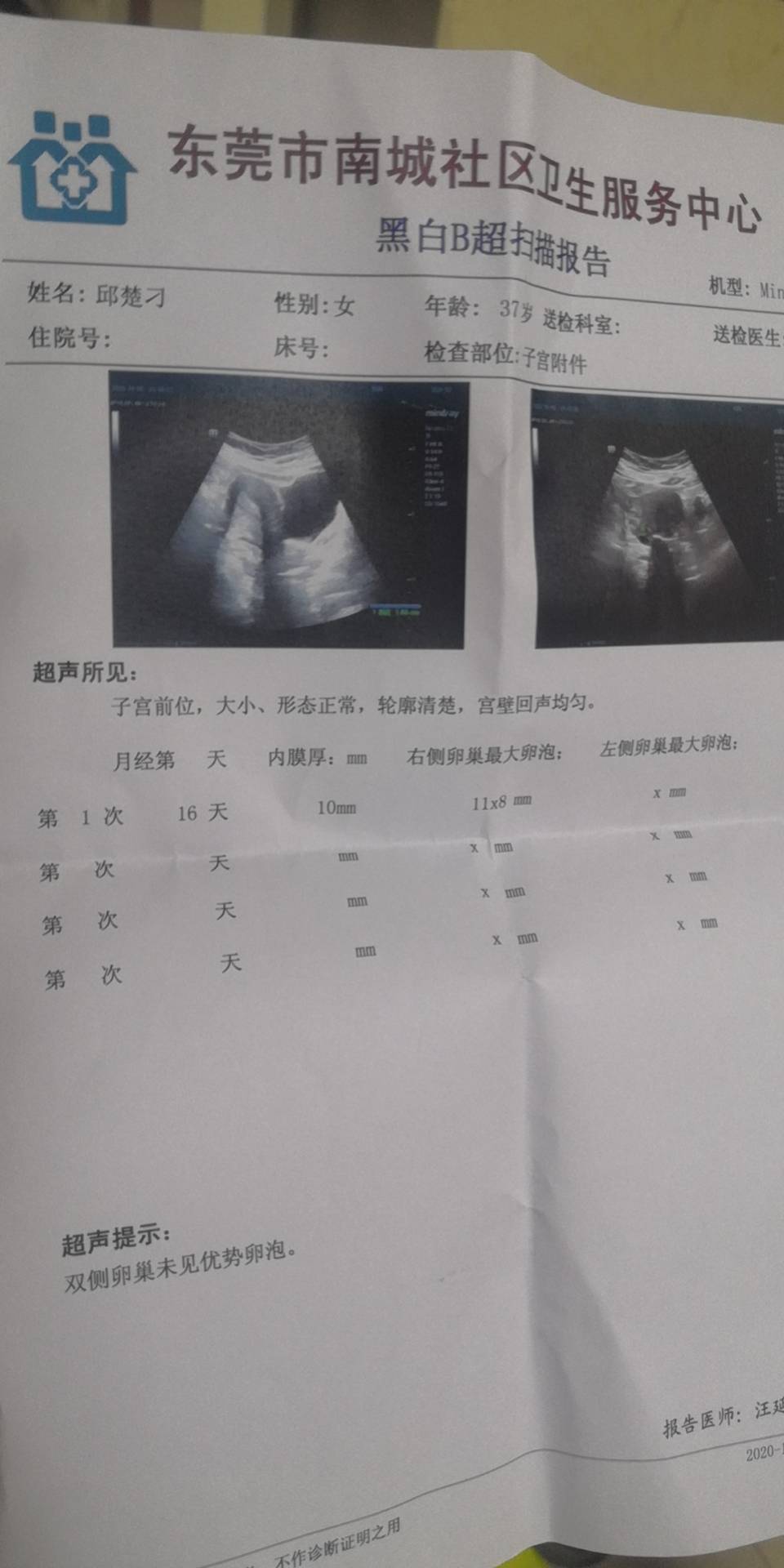 9号的B超数据今天居然阴道出血