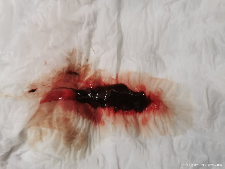 医生你好以前月经没出现过这种情况这个月推迟了