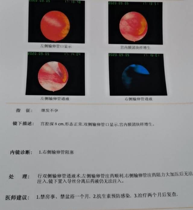 17年4月份结婚五月份怀孕十月初将近19周半