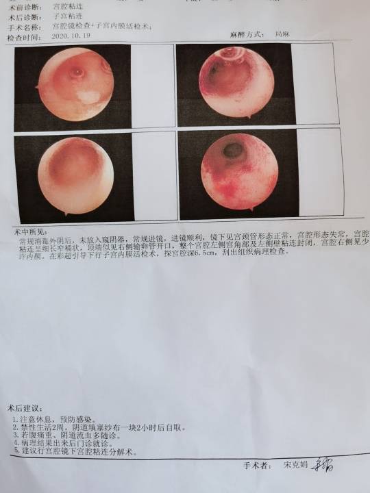 医生您好6年前胎停育清宫半年左右再次怀孕孕期