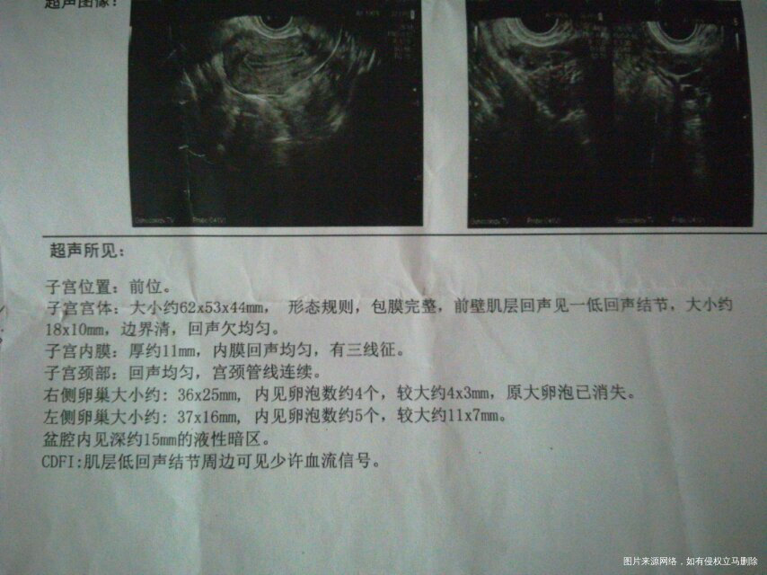 两次移植共5个第4天桑椹胚着床失败看中医诊断