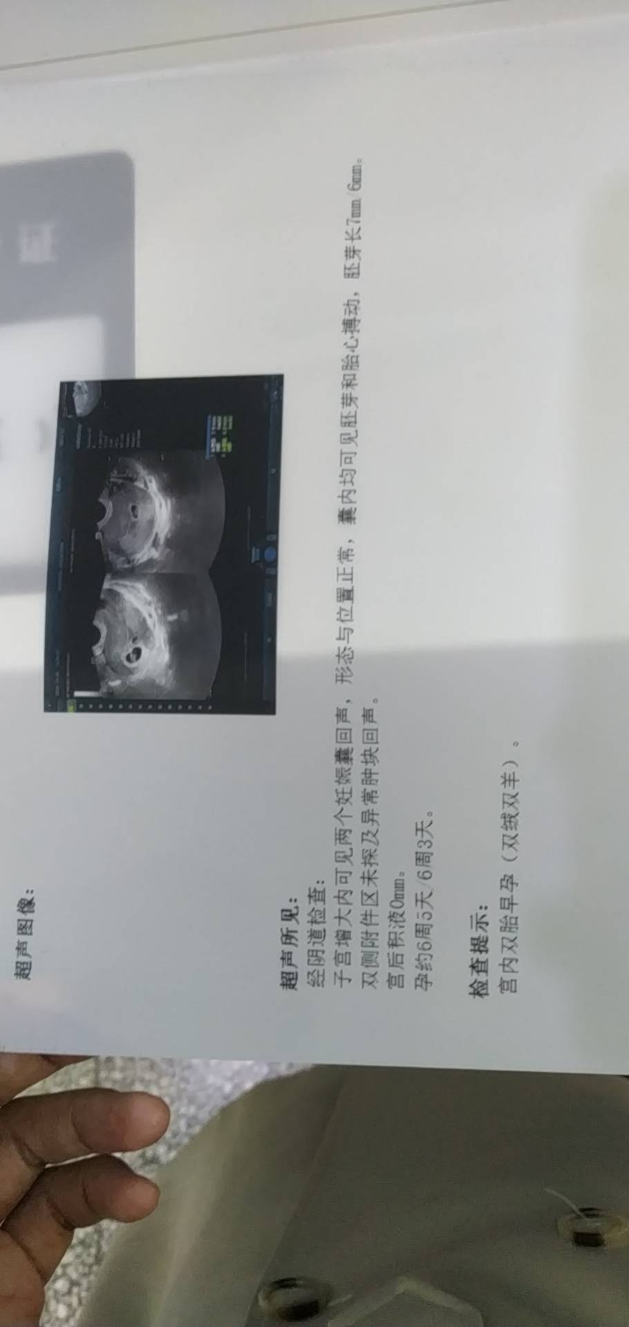 医生你好我今天是冻胚移植第32天做B超的结果