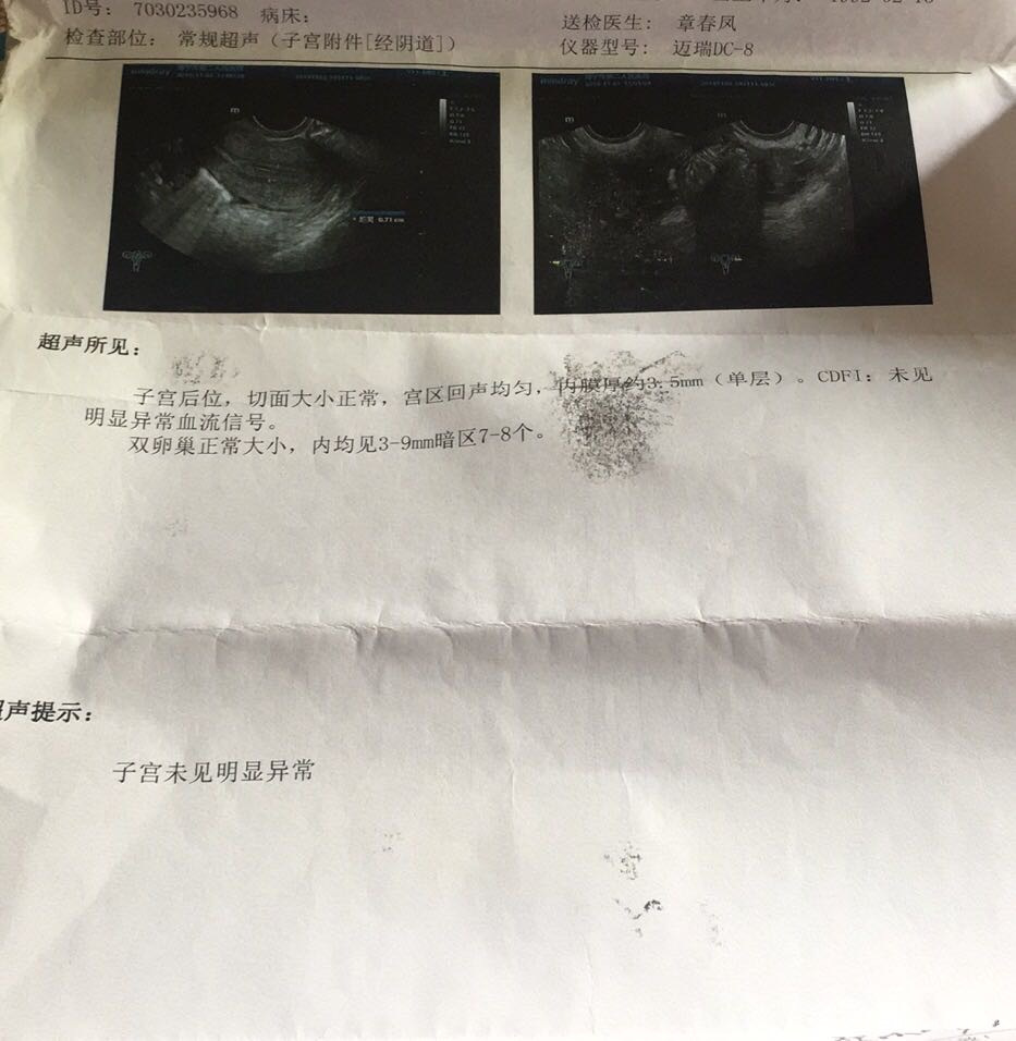 能帮我看看这是什么情况