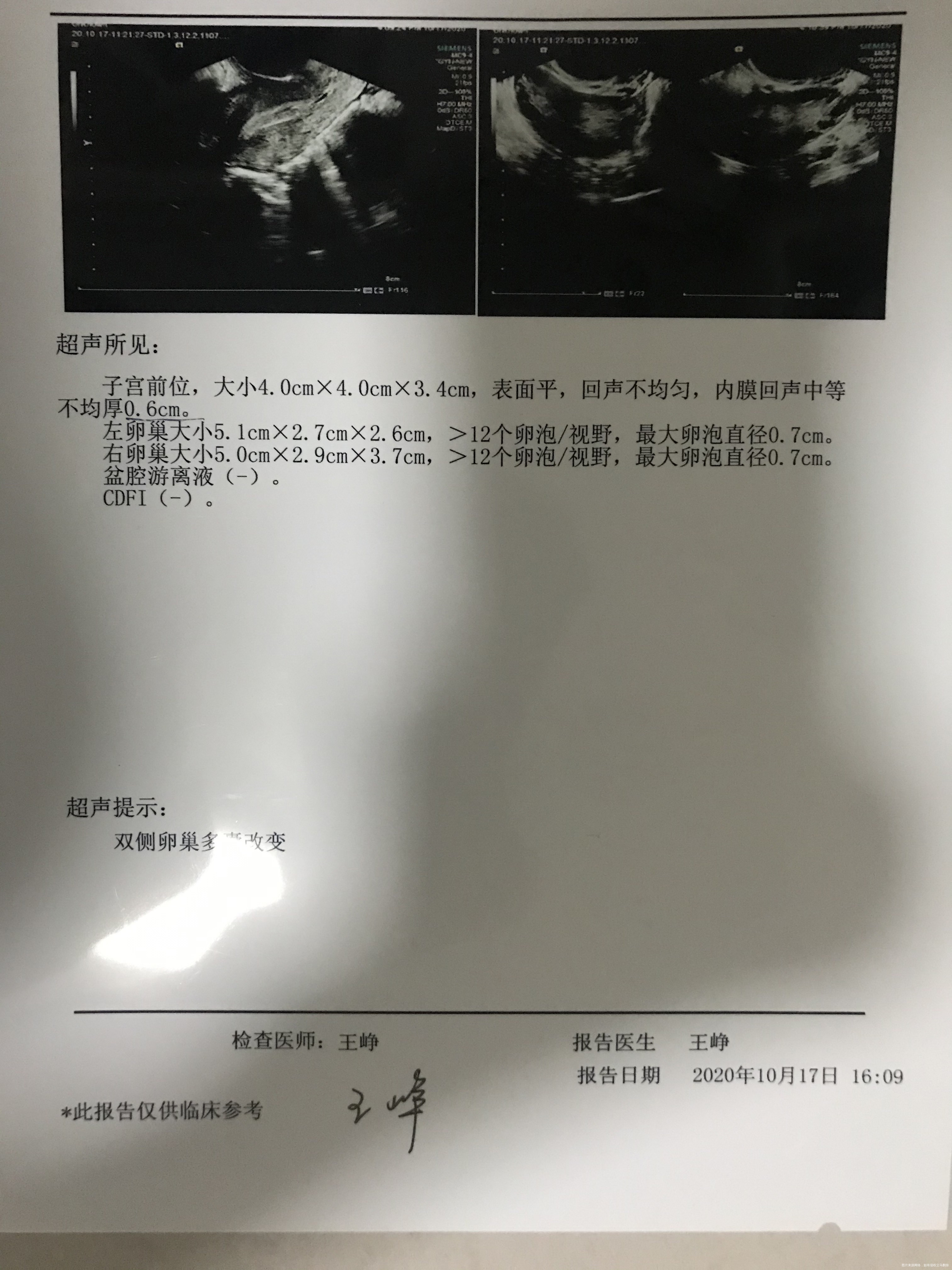 目前备孕期中药调理半年多近期做了激素六项和阴
