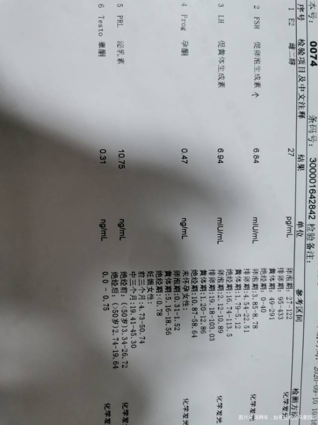 2019年7月29日子宫输卵管造影宫腔充盈欠