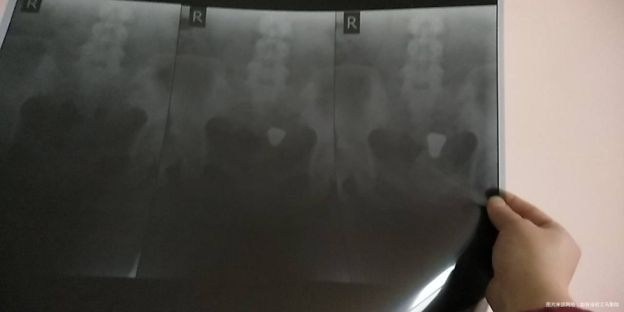 妇科都看没什么问题就这个问题严重