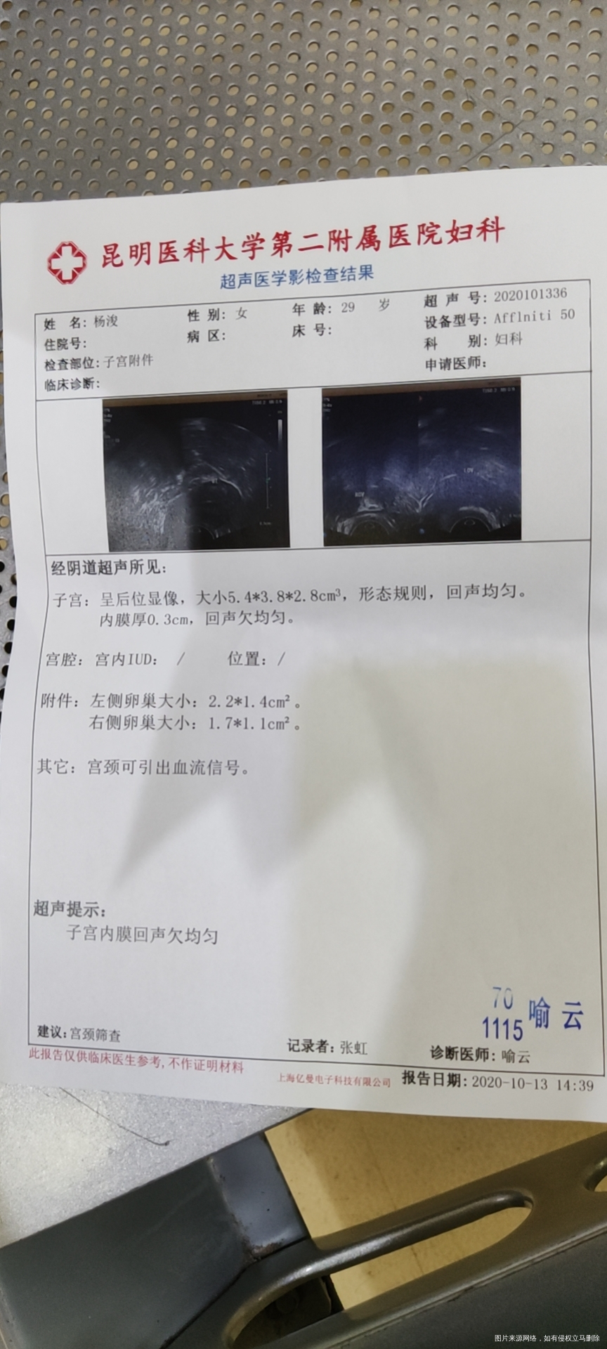 有045cm的垂体瘤内膜03cm泌乳素250