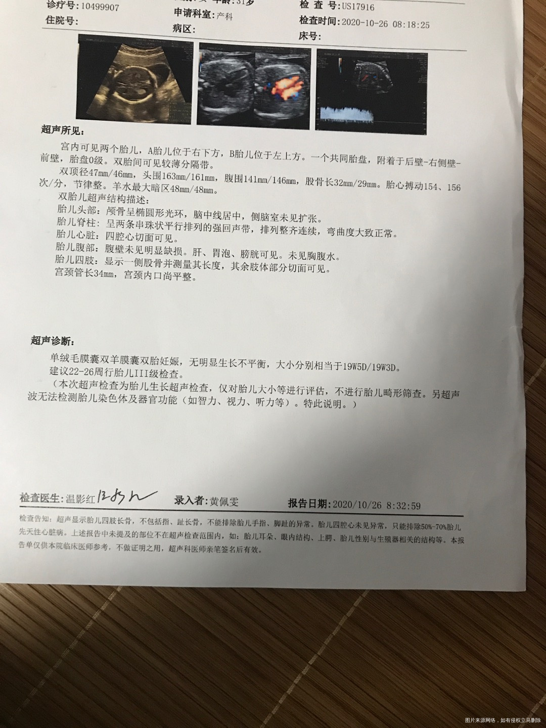 怀孕双胎19周昨天产检一切正常B超显示正常但