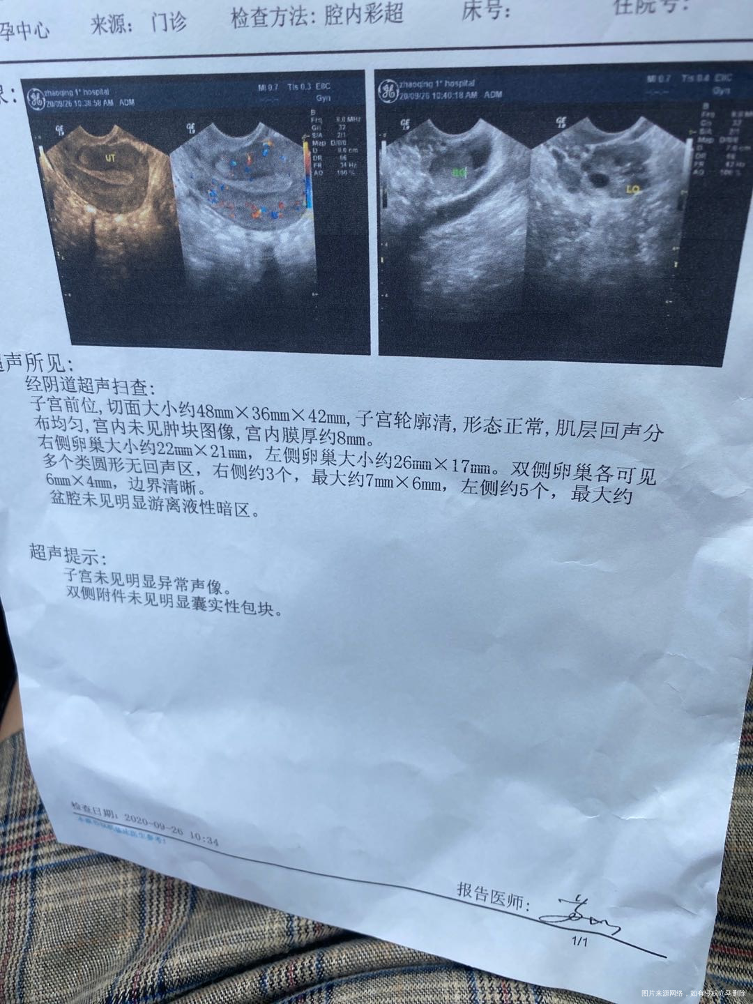 这种情况还能自然怀孕吗还是做试管机率大些