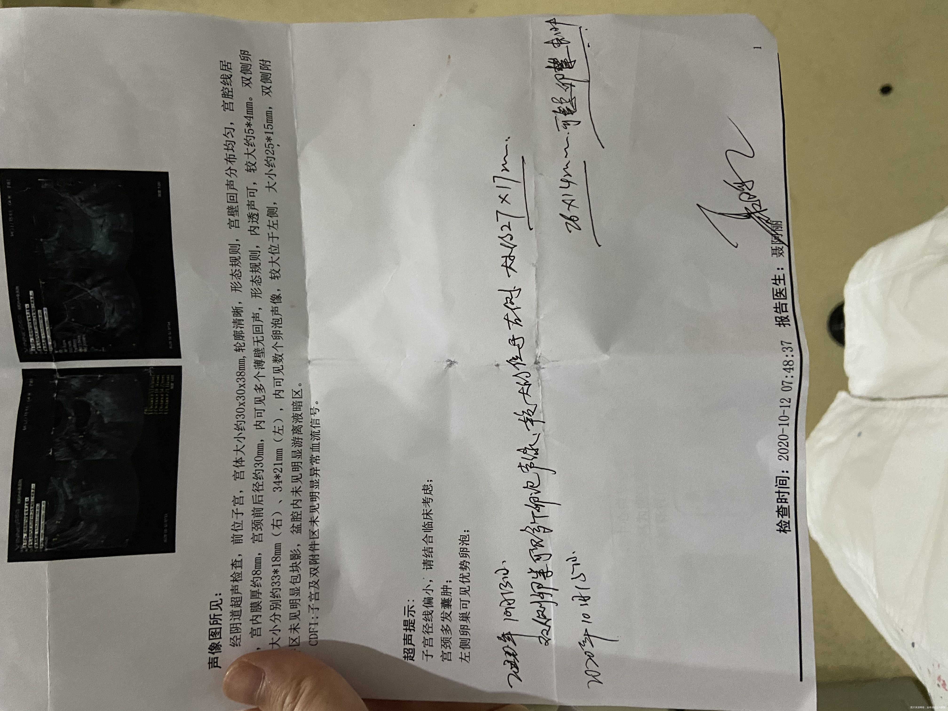 从8月份开始备孕但是因为我和我老公都经常夜班