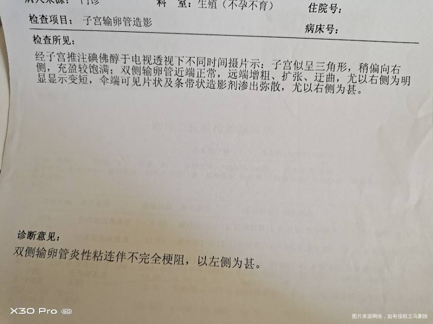 这个月12号做了造影结果双侧输卵管炎性粘连伴
