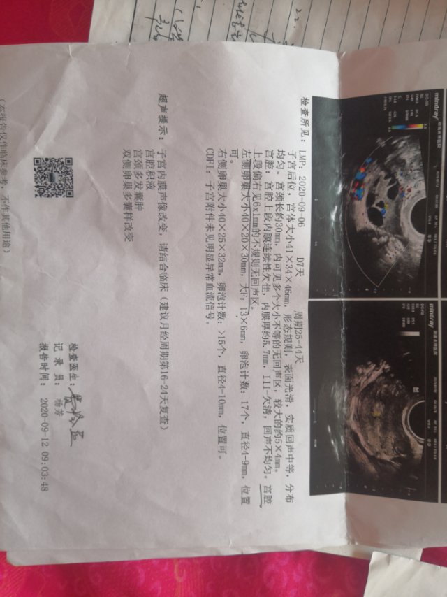 医生您好您可以帮我看下下面的单子吗1激素是在