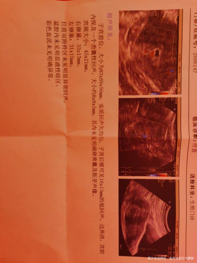 移植冻胚28天孕囊8x7x6无胎心胎芽无卵黄