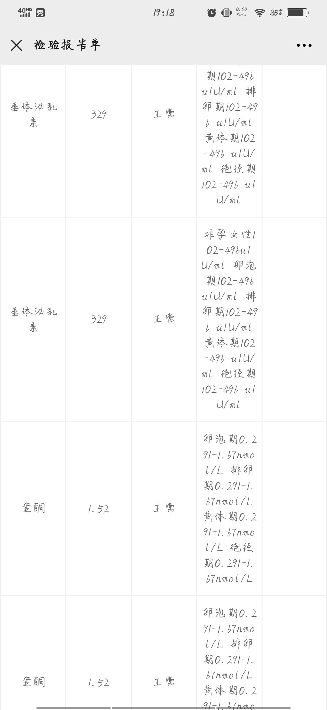 医生我3个月前泌乳素和睾酮高了医生说是多囊卵