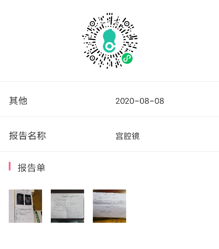 去年10月移植一次不成功今年4月6宫腔镜7月