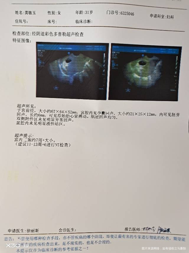 医生你好末次月经8月23日10月1号和3号分