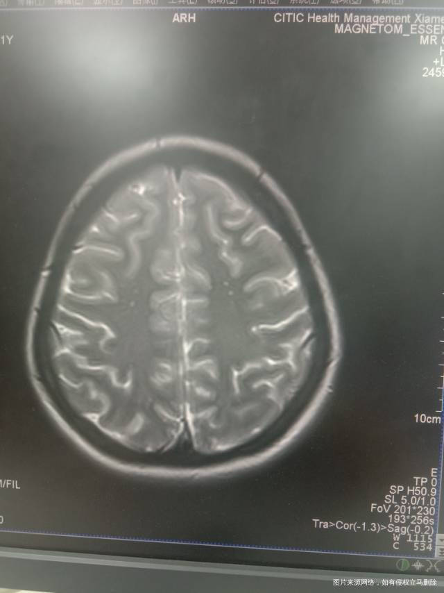 月经初潮开始就不是每个月都很规律然后去年查了