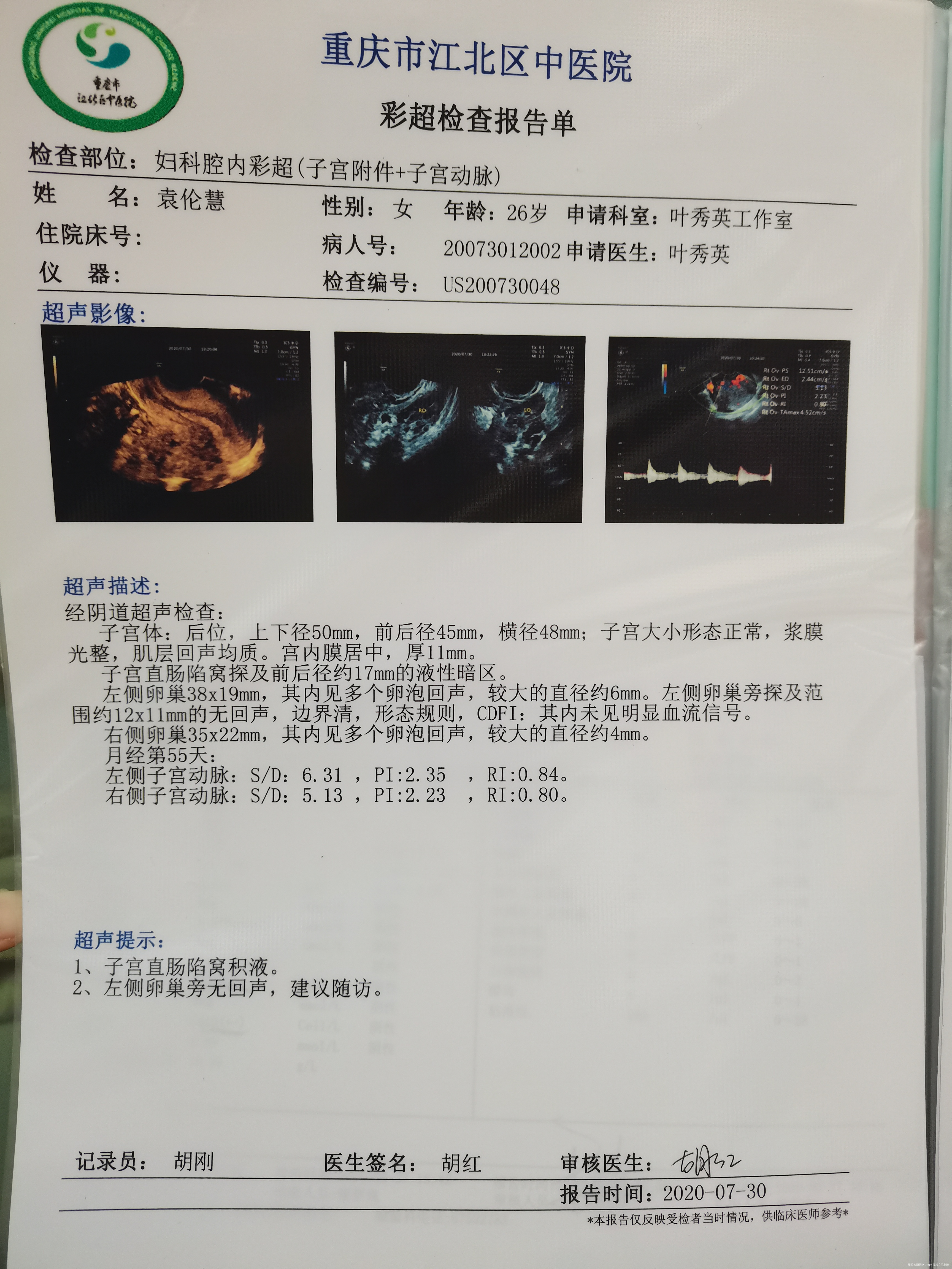 我这个月大姨妈一直没来都延迟快一个月了之前在