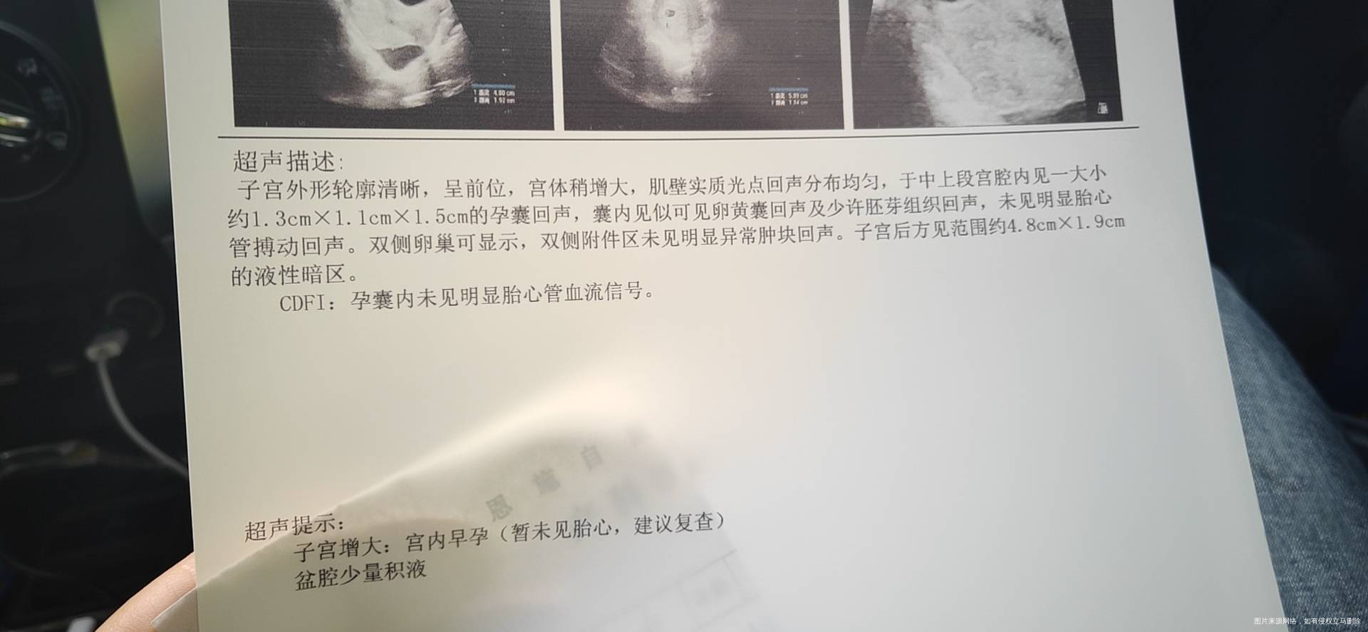 做了B超医生说发育小跟我怀孕的天数不符有停育
