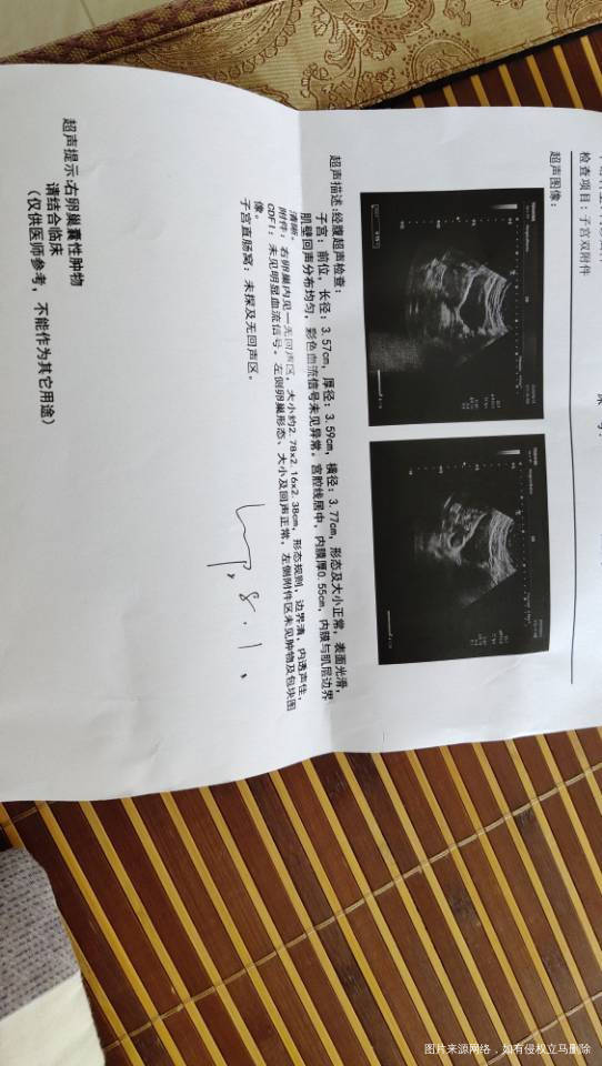 医生我3个月前泌乳素和睾酮高了医生说是多囊卵