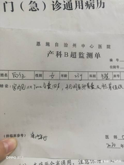 停经47天我昨天做了阴超宫内但是今天腹痛流血