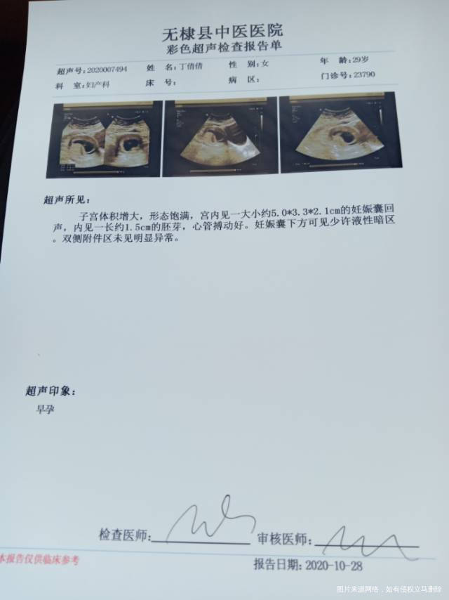 有液体暗区需要保胎吗