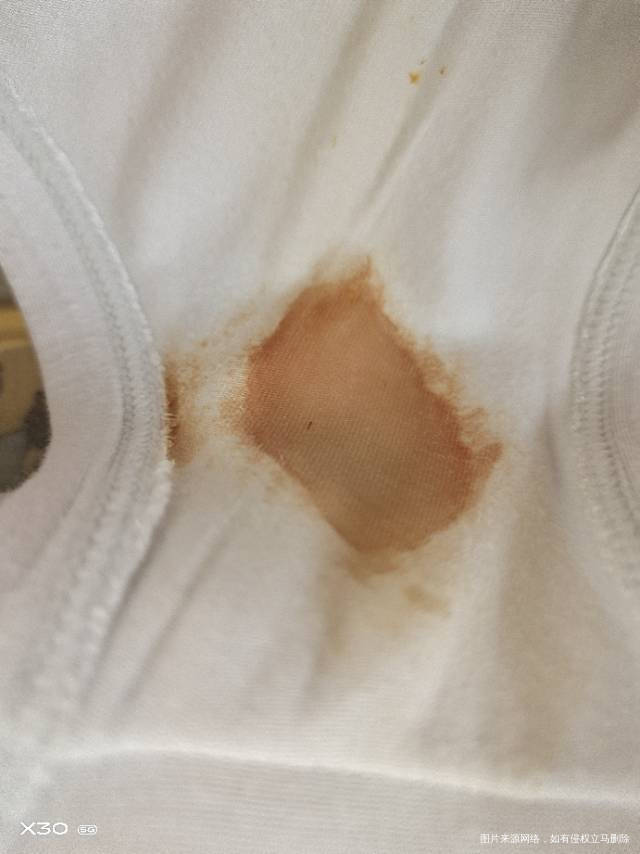 医生你好末次月经8月23日10月1号和3号分