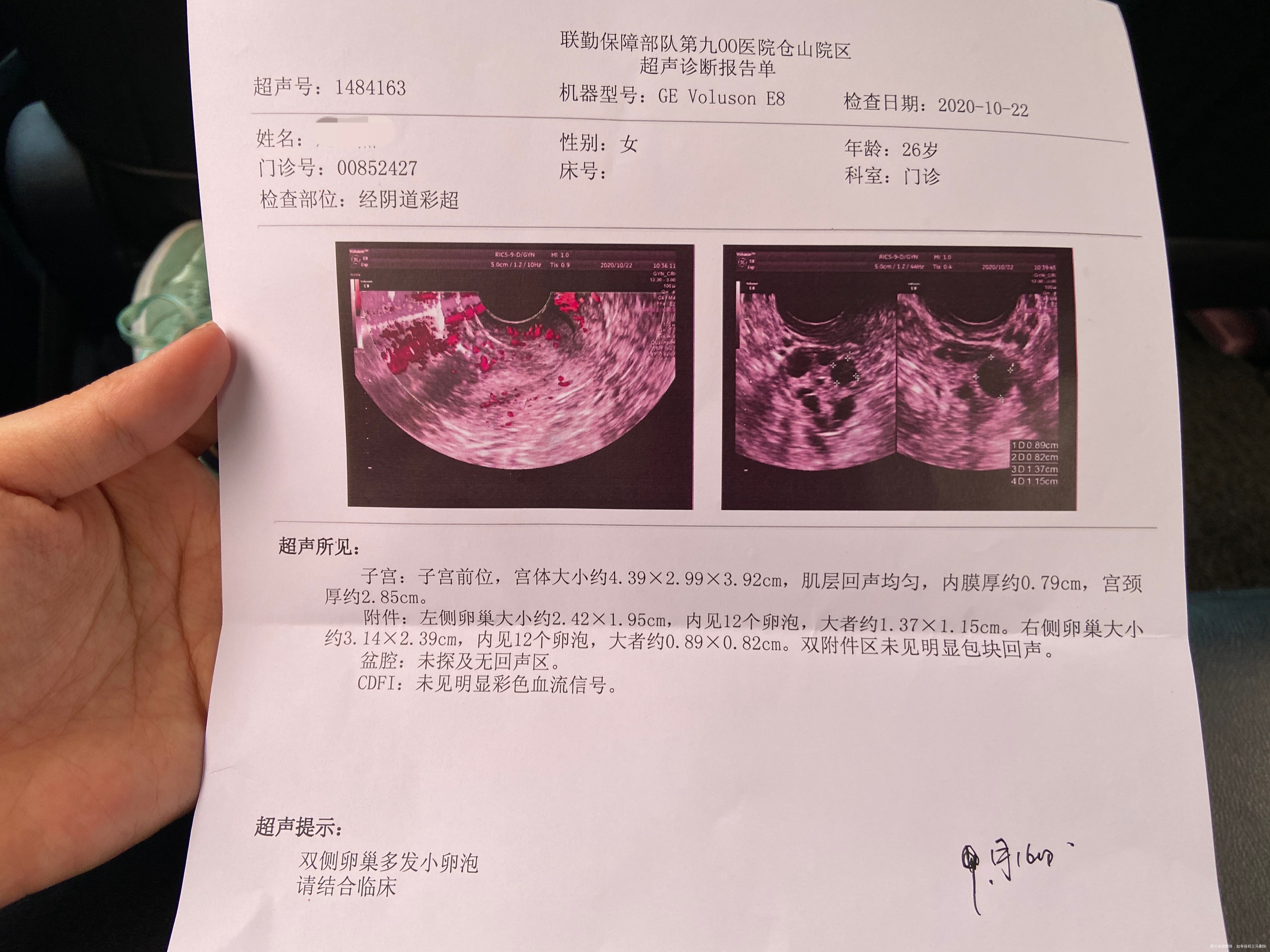 内分泌失调结婚一年无措施性生活平均一月一次月