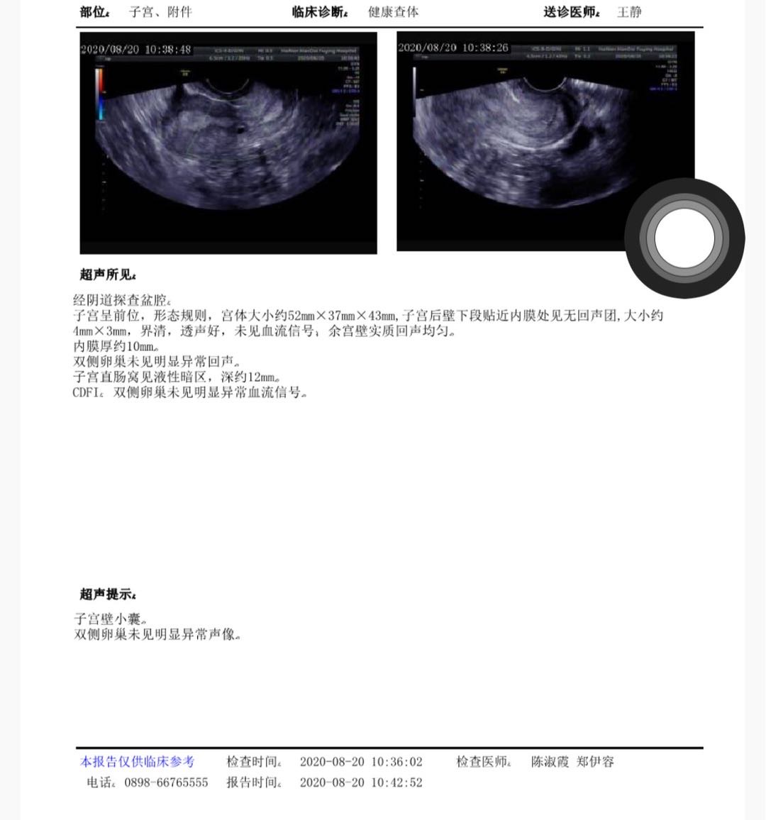7月22号来了月经8月没来九月3号吃了妇科调