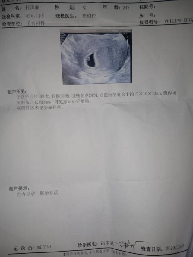 医生你好我是第一次怀孕现在意外怀孕有44或4