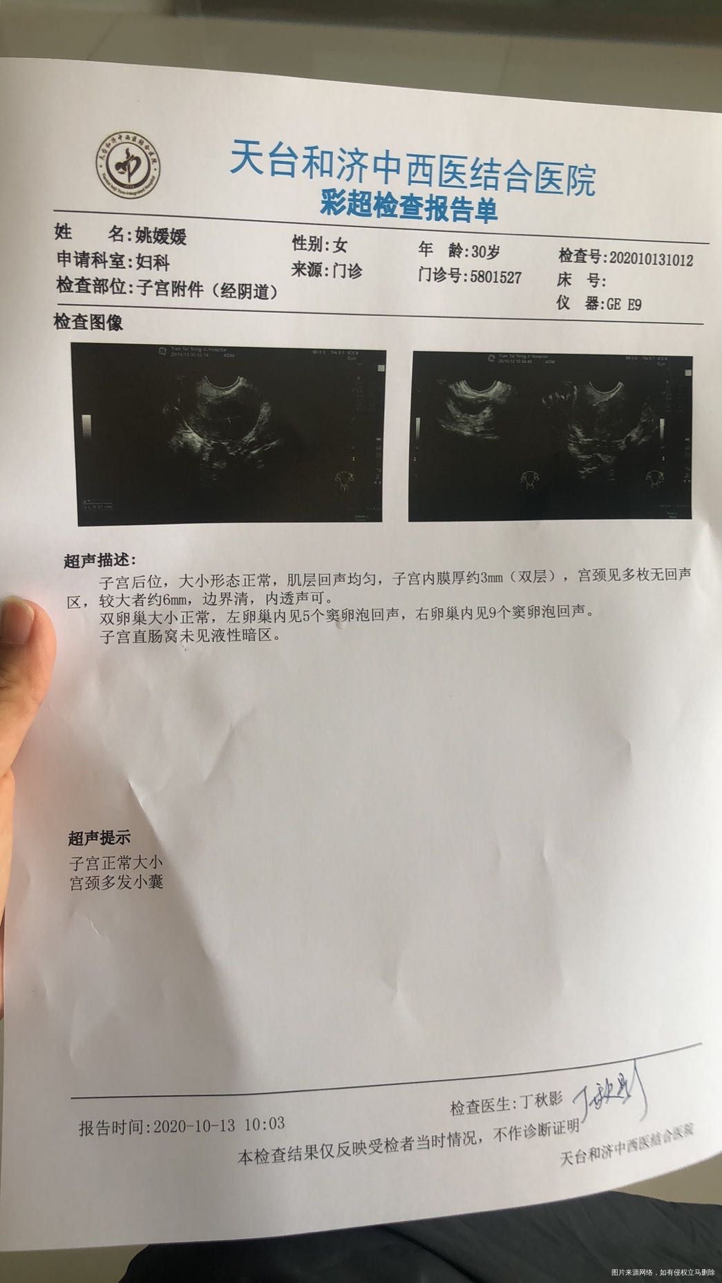 月经第四天做的窦卵泡数检查这个数量正常么