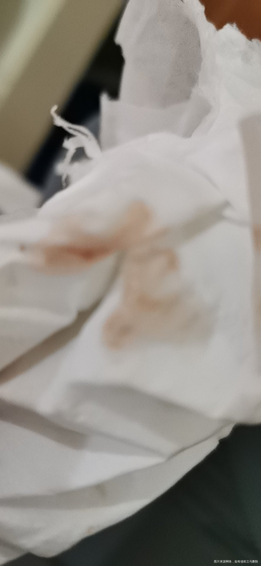 吃了三天来曲有轻微出血怎么办