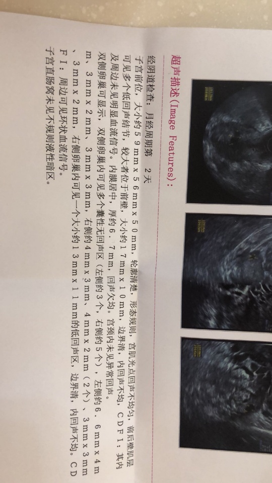 我46岁这个是月经第二天激素报告FSH高能促