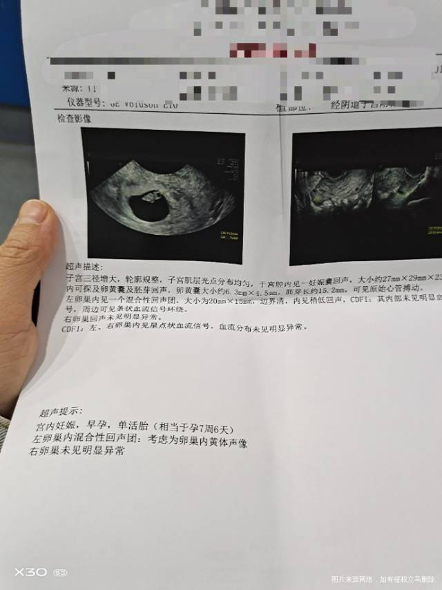 医生你好末次月经8月23日今天中午开始右下腹