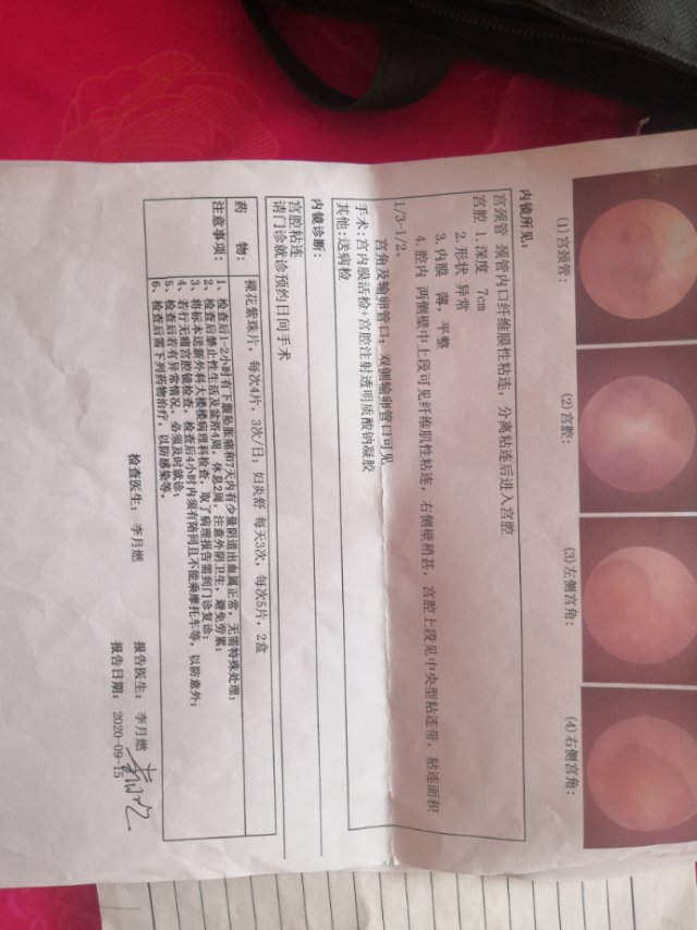 医生您好您可以帮我看下下面的单子吗1激素是在