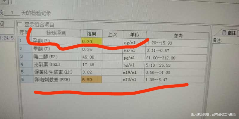 帮忙看下激素正常吗上月去监测卵泡医生说是多囊