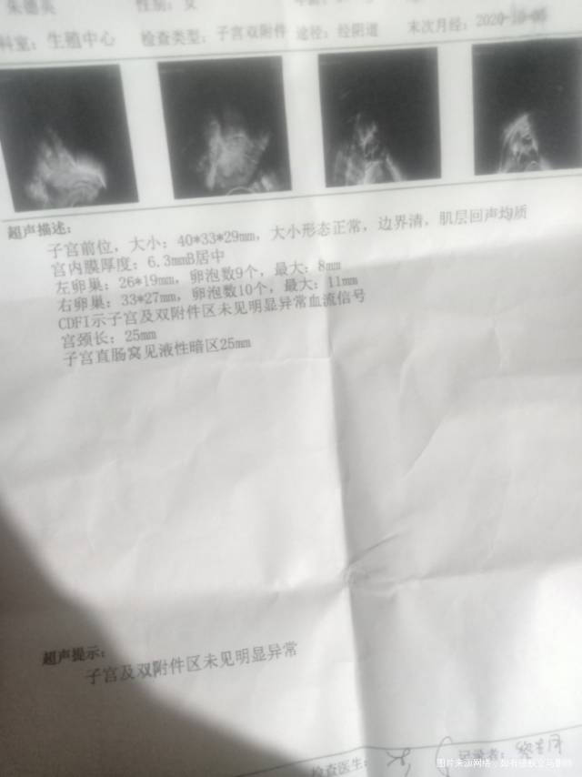 输卵管结核吃药一年半了在结核科和妇科来回跑妇