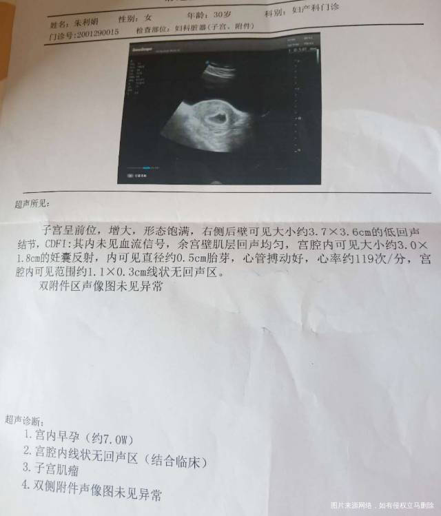 请大夫帮我看看这个彩超单提示有哪些问题我该怎