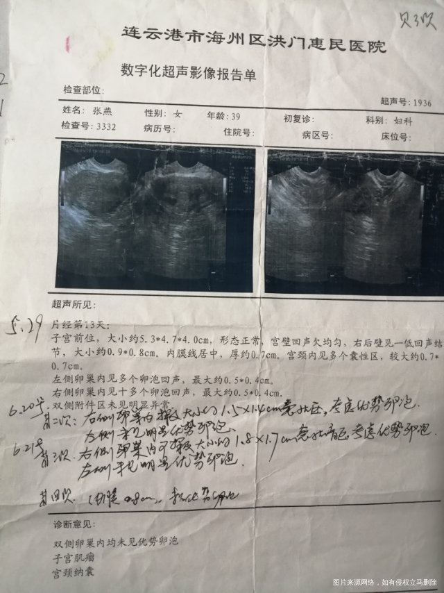 一月份取环三个月后备孕但是老公经常出差排卵期