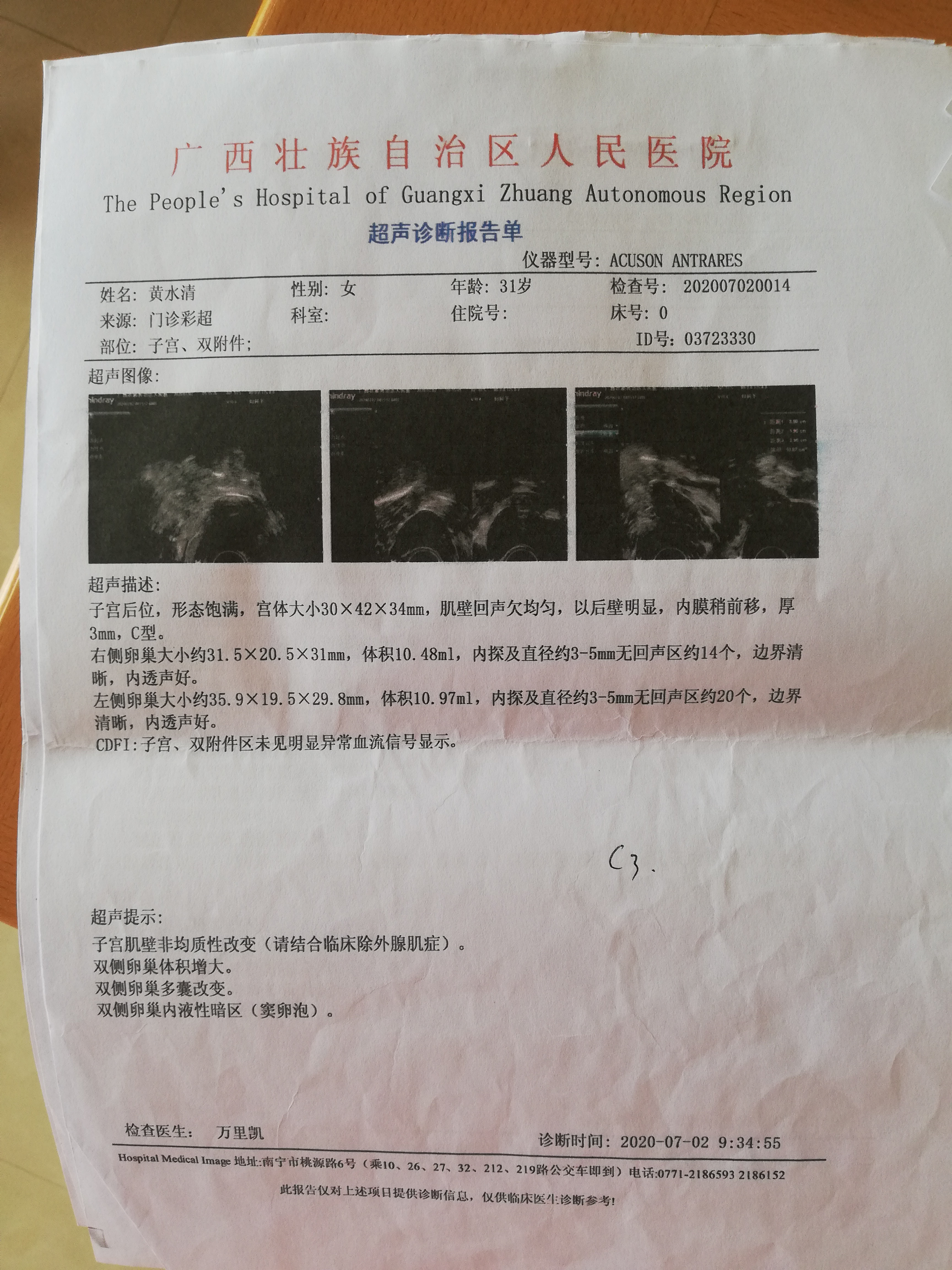 多囊促排之后成功怀孕八周胎停我想查胎停原因需